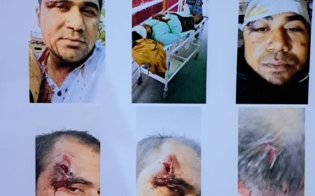 हाईकोर्ट ने आरोपियों की याचिका खारिज की, ट्रायल का सामना करेंगे शैलेन्द्र, अमन और सचिन मिश्रा