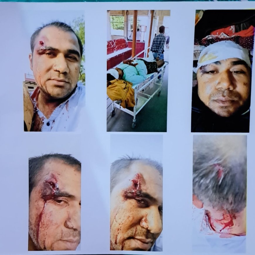 हाईकोर्ट ने आरोपियों की याचिका खारिज की, ट्रायल का सामना करेंगे शैलेन्द्र, अमन और सचिन मिश्रा