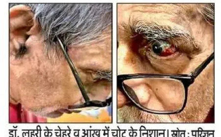 BHU के ICU में पद्मश्री डॉ. टीके लहरी से कथित बदसलूकी और थप्पड़ का आरोप, मेडिकल बोर्ड ने शुरू की जाँच