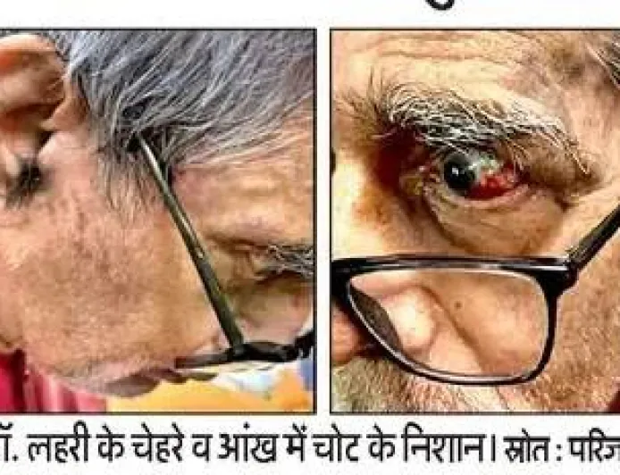 BHU के ICU में पद्मश्री डॉ. टीके लहरी से कथित बदसलूकी और थप्पड़ का आरोप, मेडिकल बोर्ड ने शुरू की जाँच