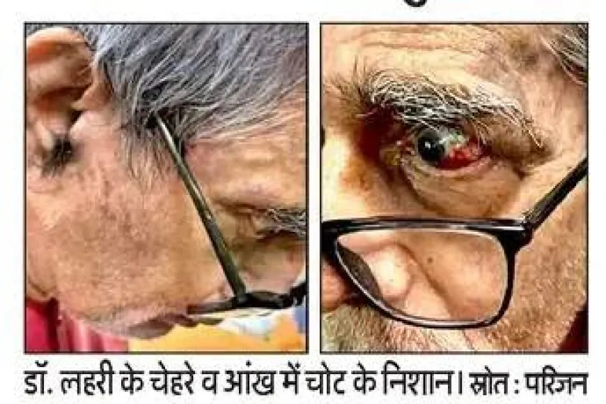 BHU के ICU में पद्मश्री डॉ. टीके लहरी से कथित बदसलूकी और थप्पड़ का आरोप, मेडिकल बोर्ड ने शुरू की जाँच